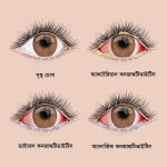 রাগ নিয়ন্ত্রণে সহজ কৌশল