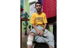 দু'পায়েই গুলি:উন্নত চিকিৎসা না পেয়ে পঙ্গুত্বের শঙ্কায় দিন কাটছে বেল্লালের 7 image 187672 1743046799