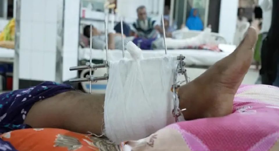 কোটা সংস্কার আন্দোলন: আমার পায়ে বন্দুক লাগায়ে শ্যুট করছে 5 bbc bangla