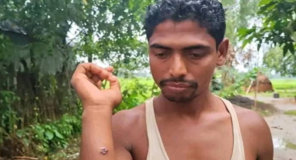 গাইবান্ধায় এক গ্রামের ১১ জনের শরীরে মিলল অ্যানথ্রাক্সের উপসর্গ 5 anthrax 68e0c479c0783